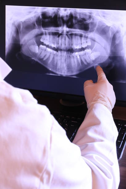 Best Tooth Infection Emergency Dentist  in Lincolnton, GA